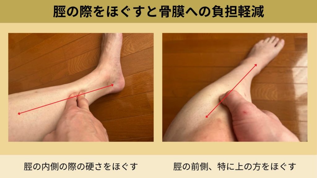 ミズノ治療院_シンスプリント_マッサージ