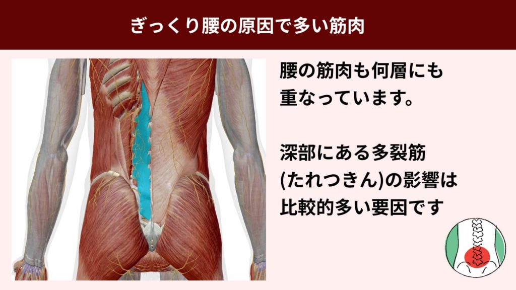 ミズノ治療院_ギックリ腰_原因