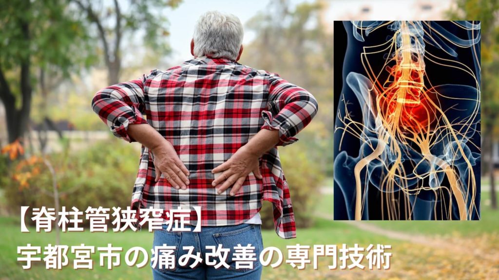 ミズノ治療院_脊柱管狭窄症