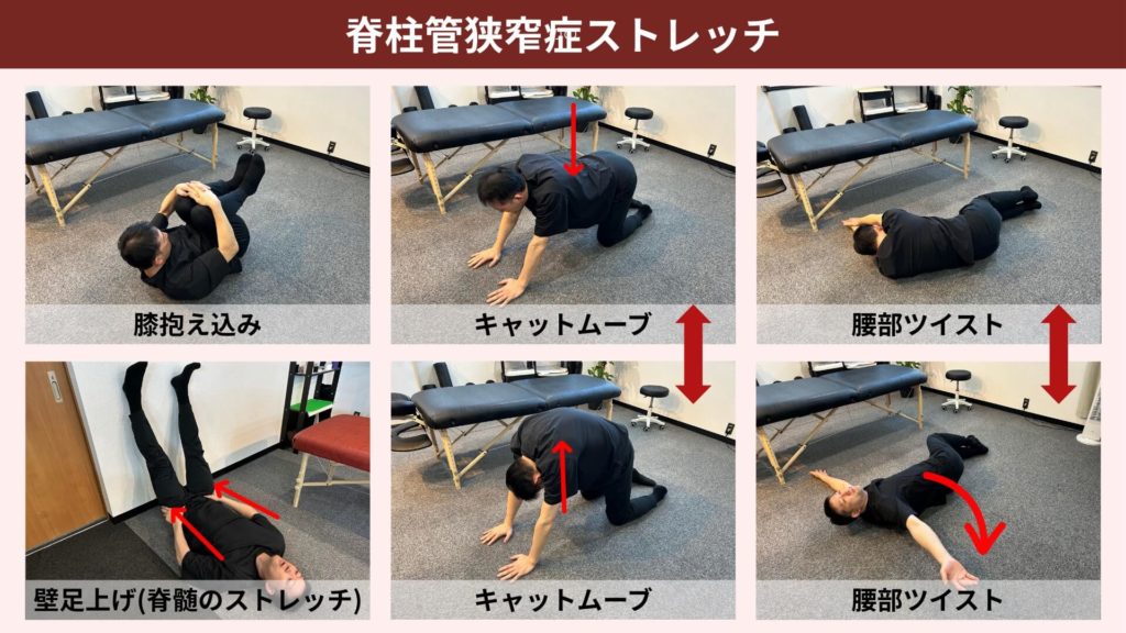 ミズノ治療院_脊柱管狭窄症_ストレッチ