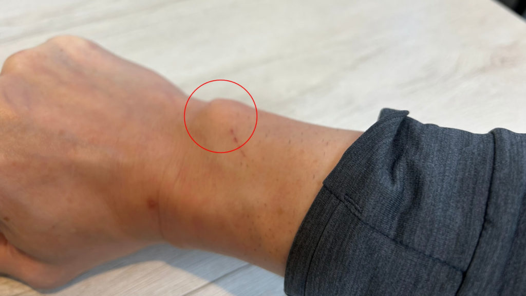 バスケ_手首_ミズノ治療院