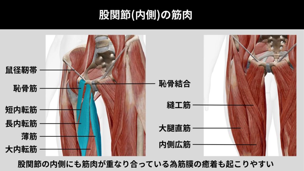 ミズノ治療院_グロインペイン