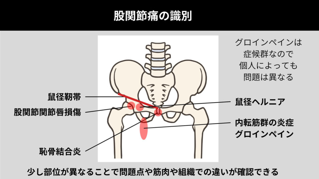 ミズノ治療院_股関節痛