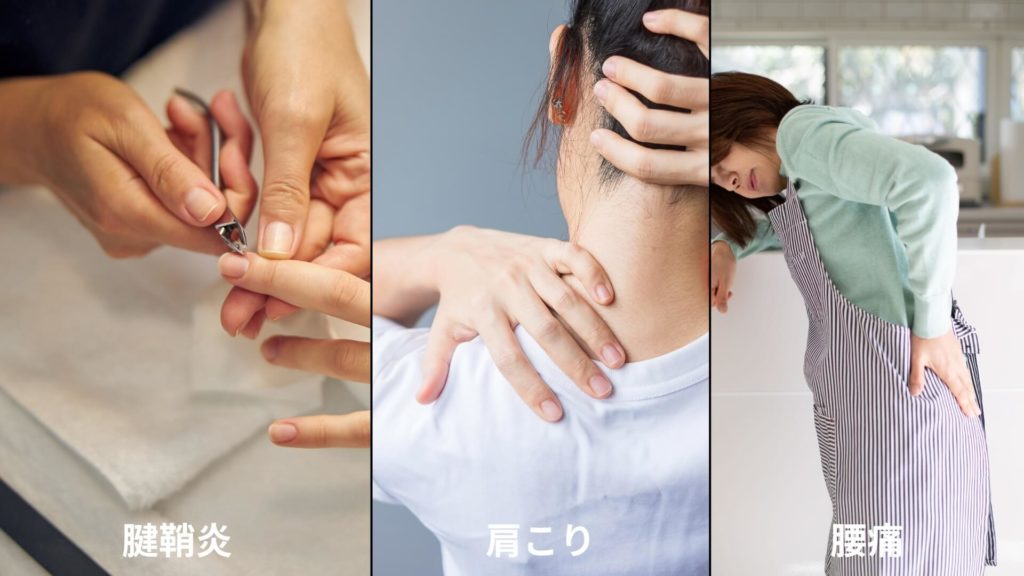 ミズノ治療院_ネイリスト職業病