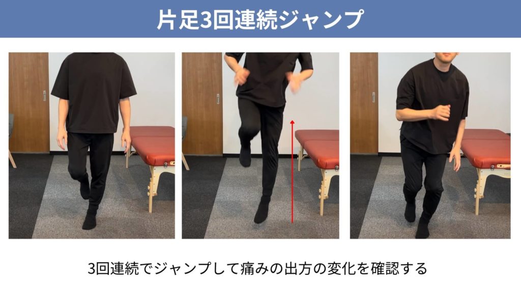 ミズノ治療院_バレーボール_シンスプリント