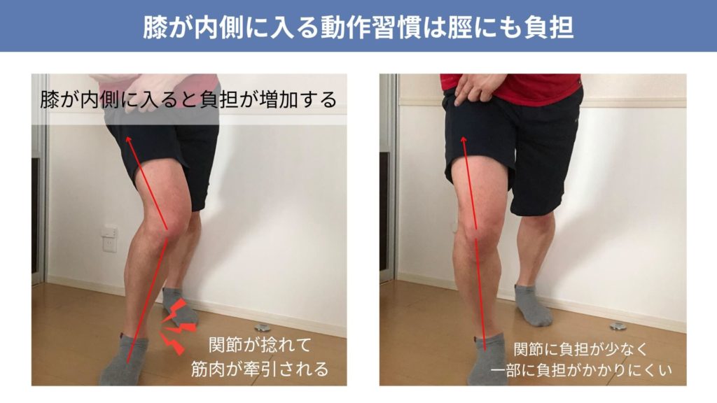 ミズノ治療院_シンスプリント_バレーボール